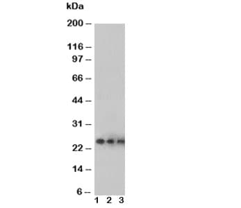 VEGFA / VEGF Antibody (aa59-74)