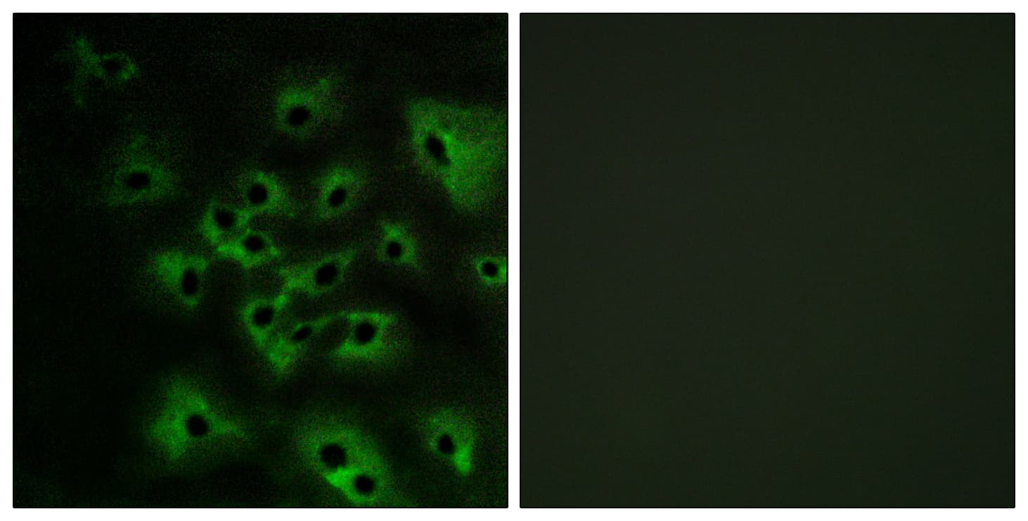 Polyclonal Rabbit anti-Human ERBB4 / HER4 Antibody (phospho-Tyr1284, IHC, IF, WB)