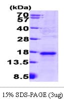 Mouse VEGFA / VEGF Protein (Recombinant His)