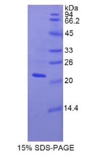 Rat FBLN5 / Fibulin 5 Protein (Recombinant His)