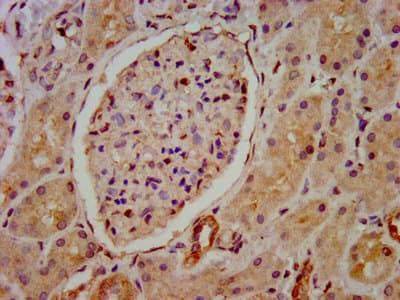 Polyclonal Rabbit anti-Human HIP1R Antibody (IHC, WB)