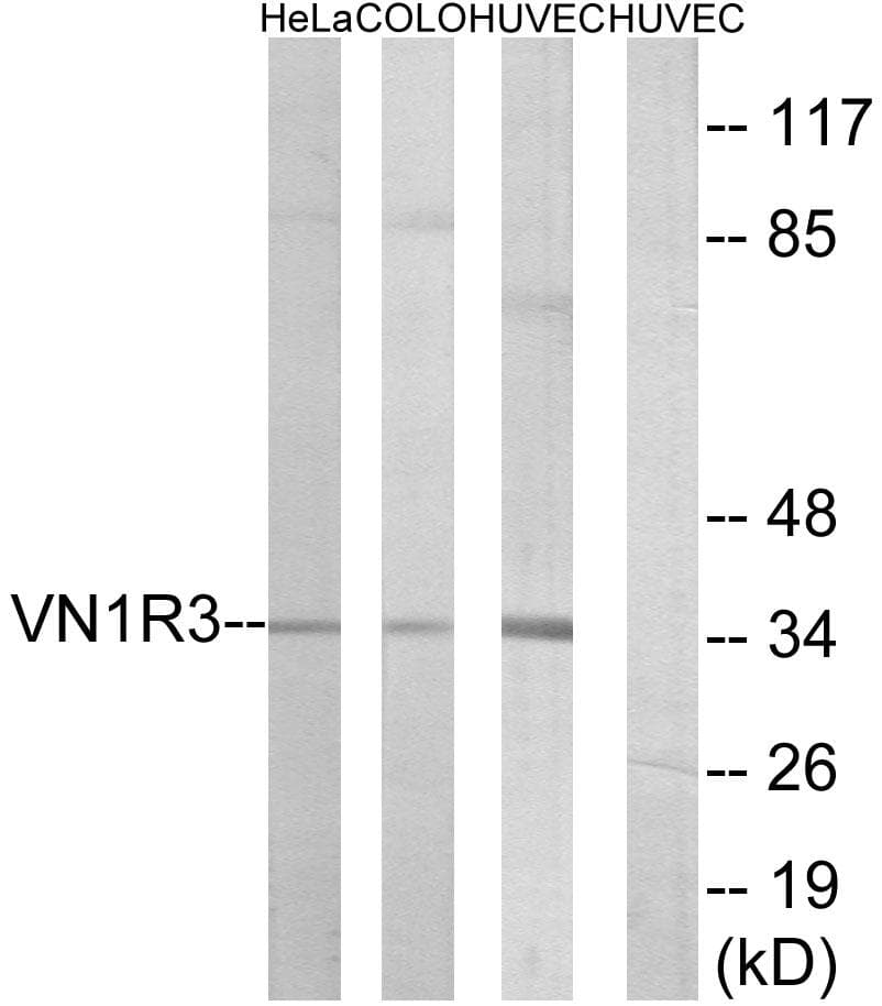 Polyclonal Rabbit anti-Human VN1R3 Antibody (WB)