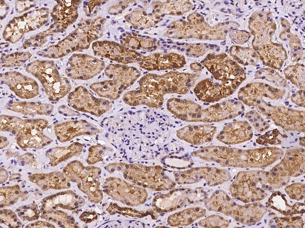 GAB2 Antibody