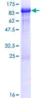 Human FETUB / Fetuin B Protein (Recombinant GST)