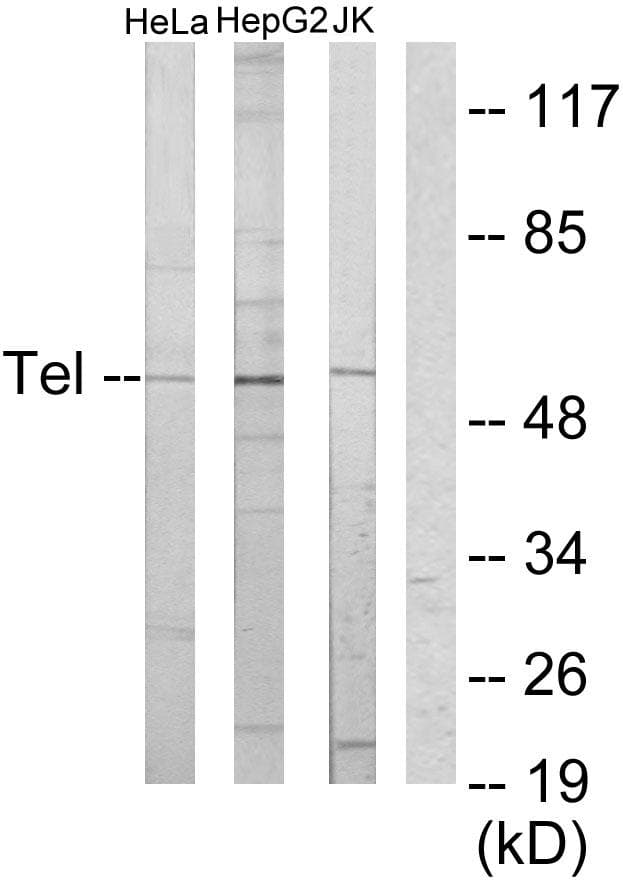 ETV6 / TEL Antibody