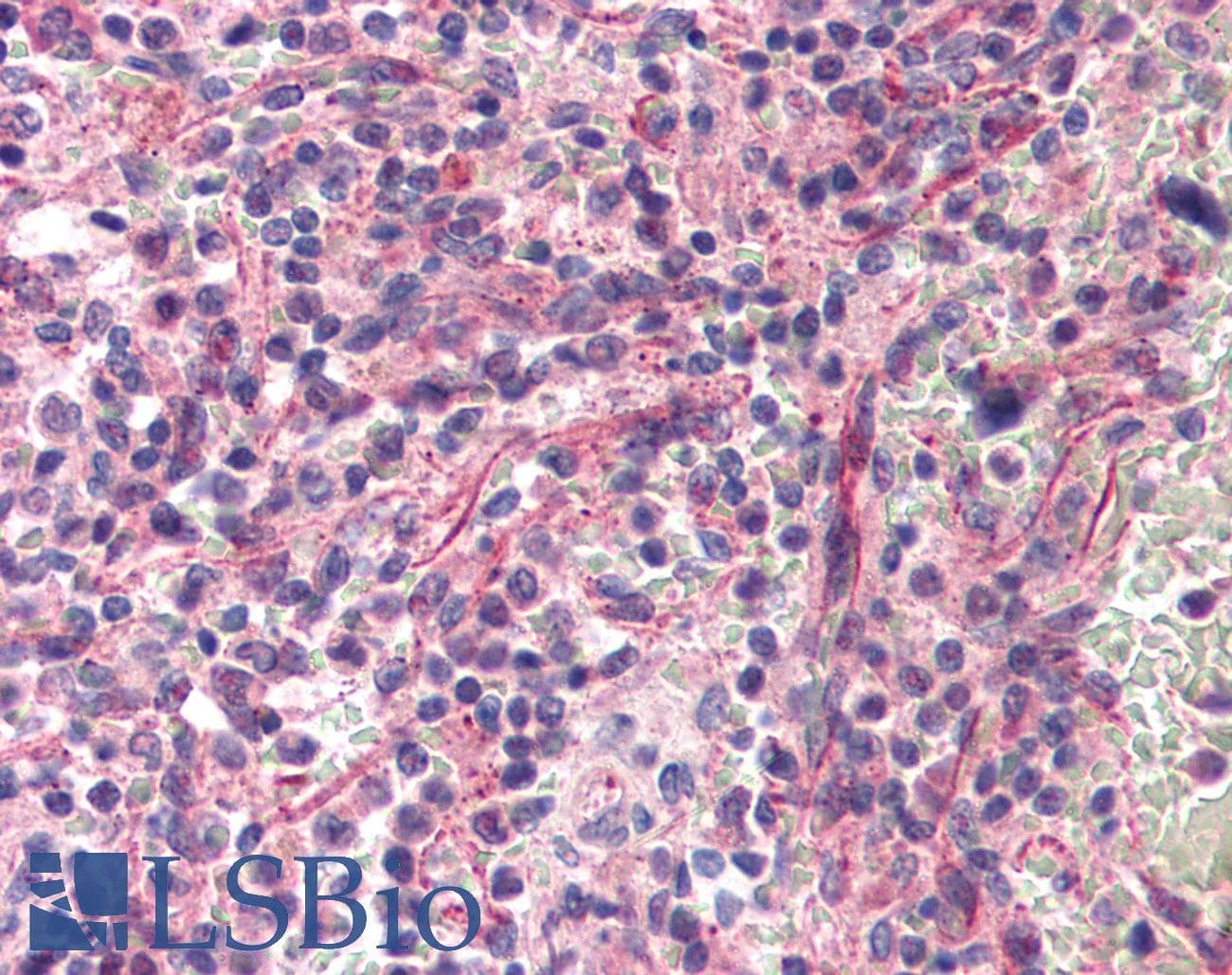 IHC-plus™ RPS6KB1 / P70S6K / S6K Antibody