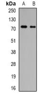 Polyclonal Rabbit anti-Human GALNT3 Antibody (WB)