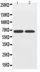 SLC2A12 / GLUT12 Antibody (aa256-272)
