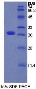 Mouse PTCH1 / Patched 1 Protein (Recombinant His-T7)