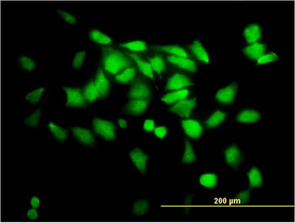 SGTA / SGT Antibody (clone 2E11)