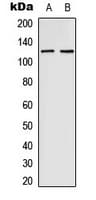 Polyclonal Rabbit anti-Human EPHB4 / EPH Receptor B4 Antibody (Internal, WB)