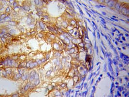 IKBKE / IKKI / IKKE Antibody