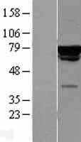 Human CHAF1B / CAF1 Protein (Over-Expression Lysate Myc-DDK (Flag))