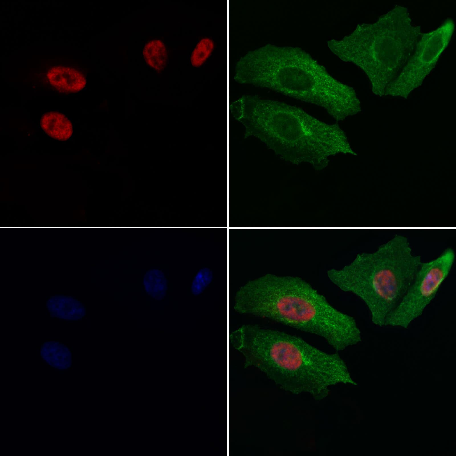 RARG / RAR-Gamma Antibody