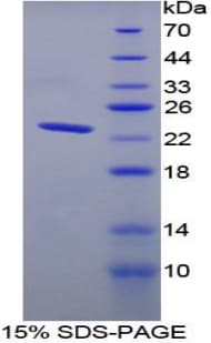 Rat TNNI2 Protein (Recombinant His)