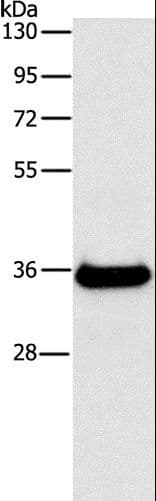 FGL1 / Hepassocin Antibody