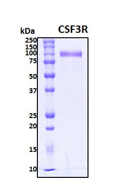 Human CSF3R / CD114 Protein (Recombinant His, N-Terminal)