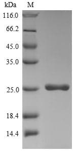 Hepatitis D Virus p24 Protein (Recombinant 6His, N-terminus + Myc, C-terminus)