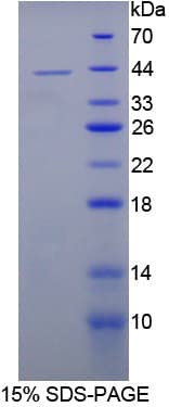 Rat IL12B / IL12 p40 Protein (Recombinant His-T7)