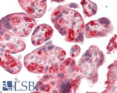 IHC-plus™ HPX / Hemopexin Antibody