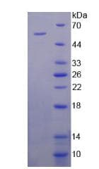 Mouse ER Alpha / Estrogen Receptor Protein (Recombinant His-GST)