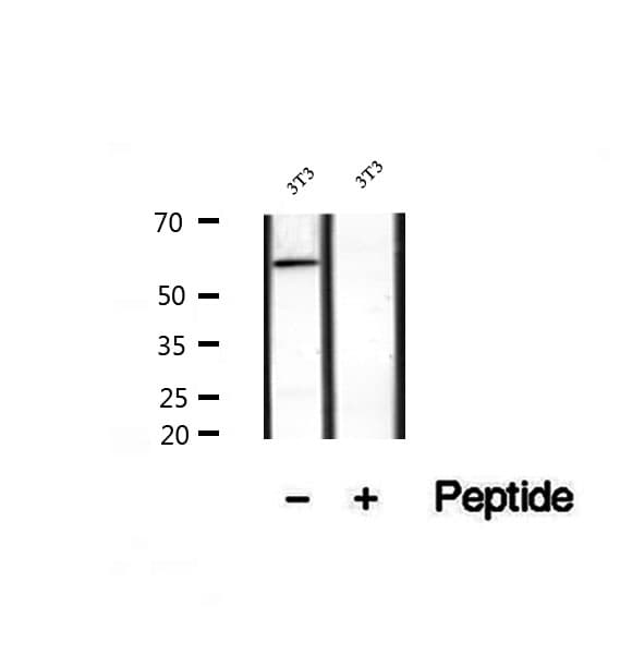 SACM1L / SAC1 Antibody