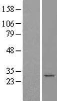 MTX2 Protein (Over-Expression Lysate Myc-DDK (Flag))