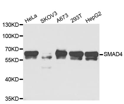 Polyclonal Rabbit anti-Human SMAD4 Antibody (IHC, IF, WB)
