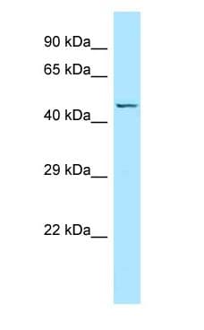 Polyclonal Rabbit anti-Human NTSR2 / NTR2 Antibody (aa223-272, WB)