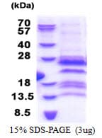 Human GAGE12F Protein (Recombinant His)