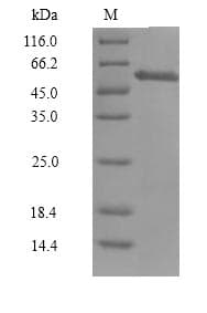 Human CCNA1 / Cyclin A1 Protein (Recombinant 6His, N-terminus)