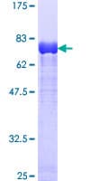Human Dynactin 2 / Dynamitin Protein (Recombinant GST)