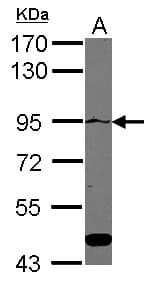 ATP2C1 Antibody (Internal)