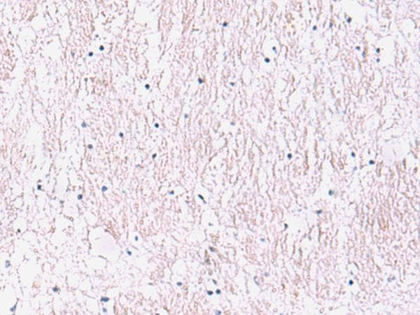 SMPD2 Antibody