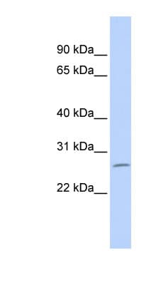 ZNF575 Antibody (aa72-121)