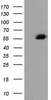 Alpha-Fetoprotein Antibody (clone OTI3B11)