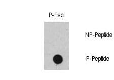 Polyclonal Rabbit anti-Human RAF1 / RAF Antibody (phospho-Ser471)