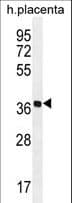 OR5AS1 Antibody (aa244-272)