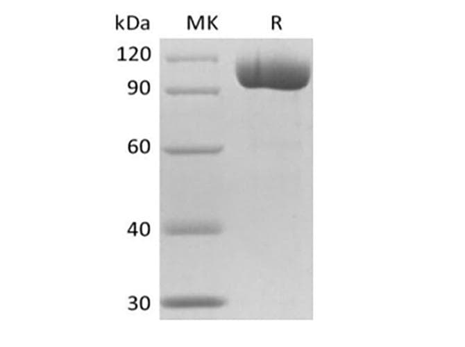 Mouse FOLH1 / PSMA Protein (Recombinant 6His, N-terminus)