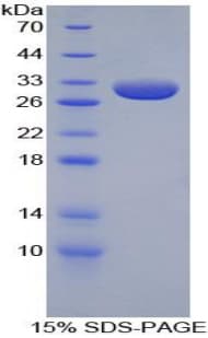 Rabbit APOA1 / Apolipoprotein A 1 (Recombinant His)