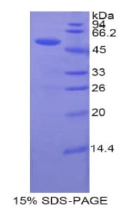 Human UPRT Protein (Recombinant His-GST)