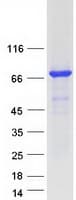 Human PRKCZ / PKC-Zeta Protein (Recombinant Myc-DDK (Flag))