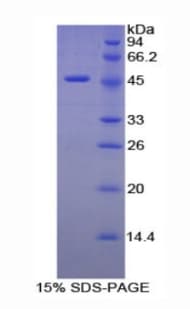 Mouse ELN / Elastin Protein (Recombinant GST-6His, N-terminus)