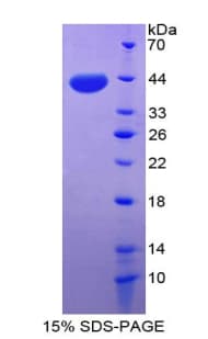 Human CXCL3 / GRO Gamma Protein (Recombinant His-GST)