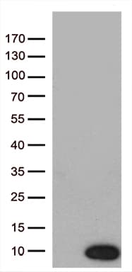 NDUFA2 Antibody (aa2-99, clone OTI5A5)