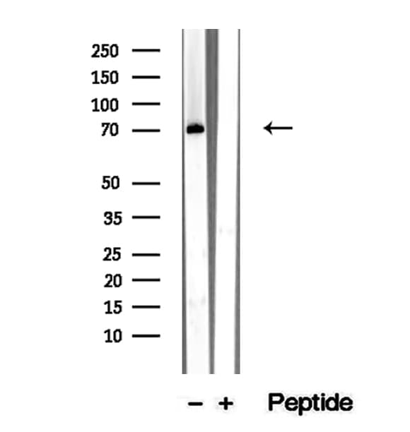 RASGRP3 / GRP3 Antibody