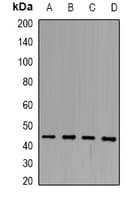 Polyclonal Rabbit anti-Human SERPINB3 Antibody (WB)