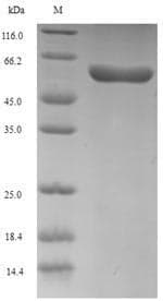 Human PDLIM1 Protein (Recombinant GST, N-terminus)