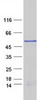 Human MAGEB10 Protein (Recombinant Myc-DDK (Flag))
