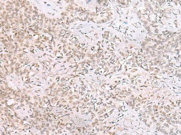 Polyclonal Rabbit anti-Human Survival Motor Neuron Domain Containing 1 (SMNDC1) Antibody (IHC)
